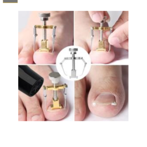 Corrector de Uñas Encarnadas